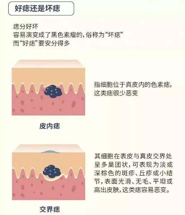 你有“好鼹鼠”还是“坏鼹鼠”?一定要学会辨别! 你有“好鼹鼠”还是“坏鼹鼠”?一定要学会辨别!