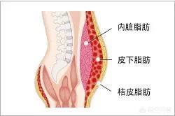 为什么腹肌会越练越扁