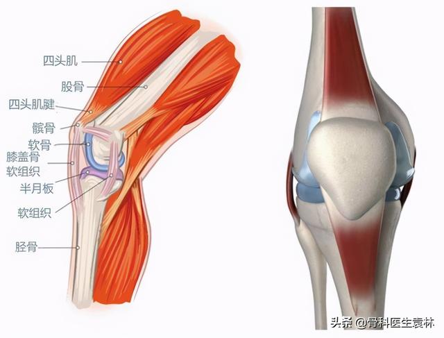 膝关节响是软骨磨损导致的 膝关节软骨损伤是怎么回事